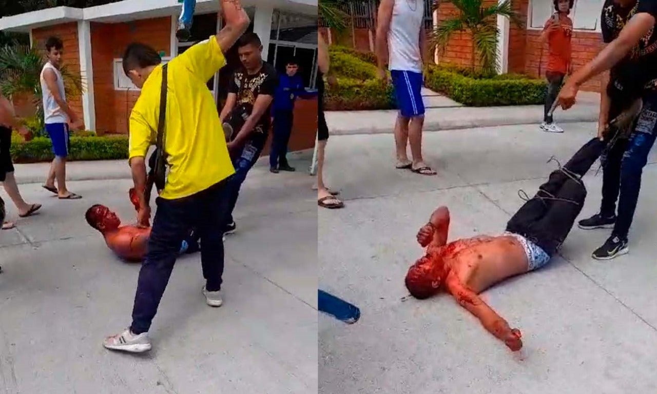 Presunto ladrón recibió palo terapia en Neiva, Huila