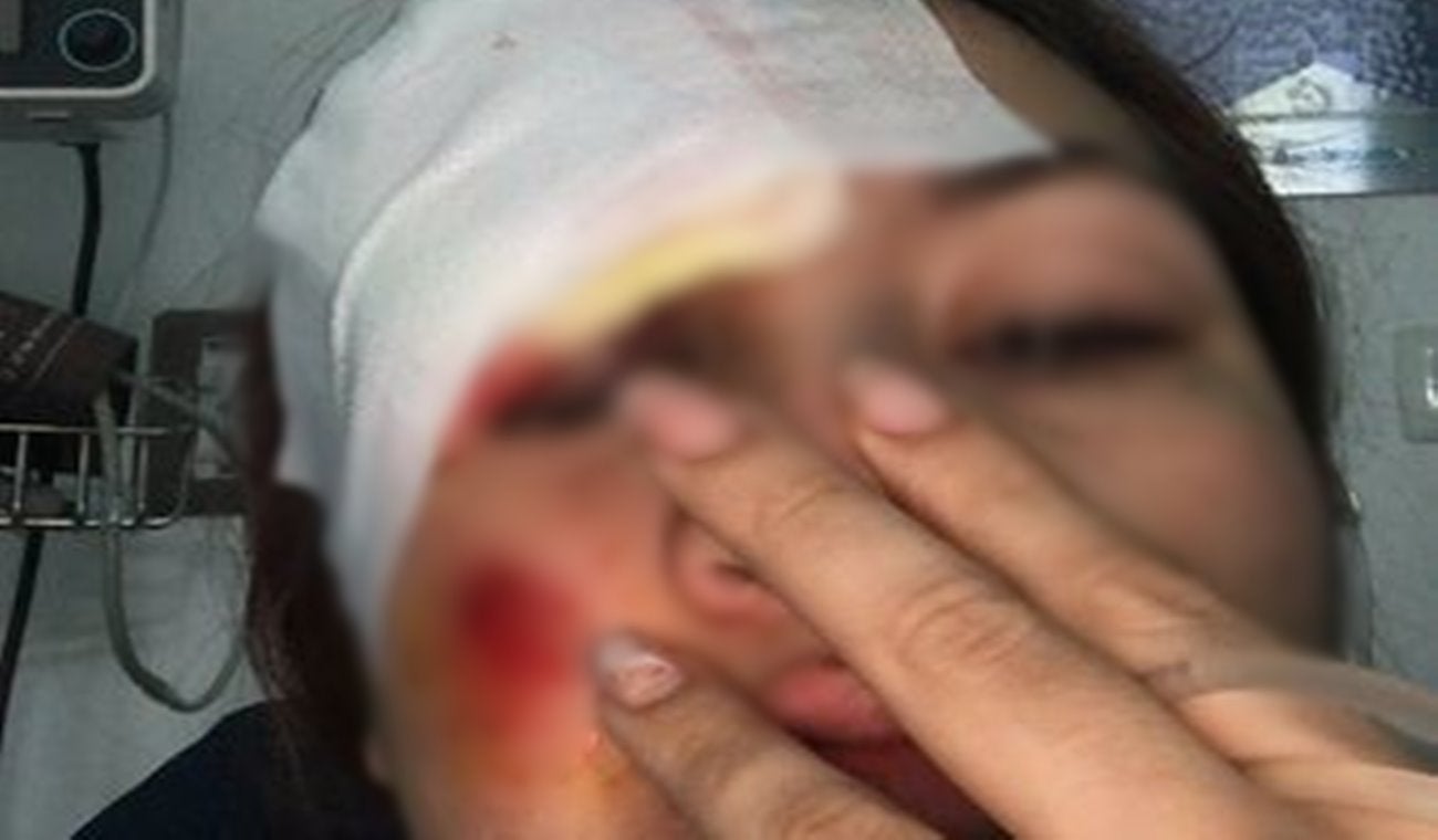 Una motociclista fue arrollada por un particular en el Jardín Santander y el conductor huyó sin auxiliarla