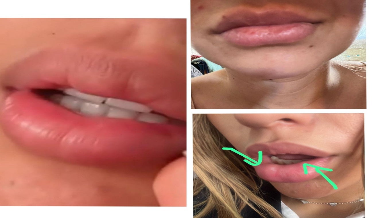 Denuncia estetica en Ibagué