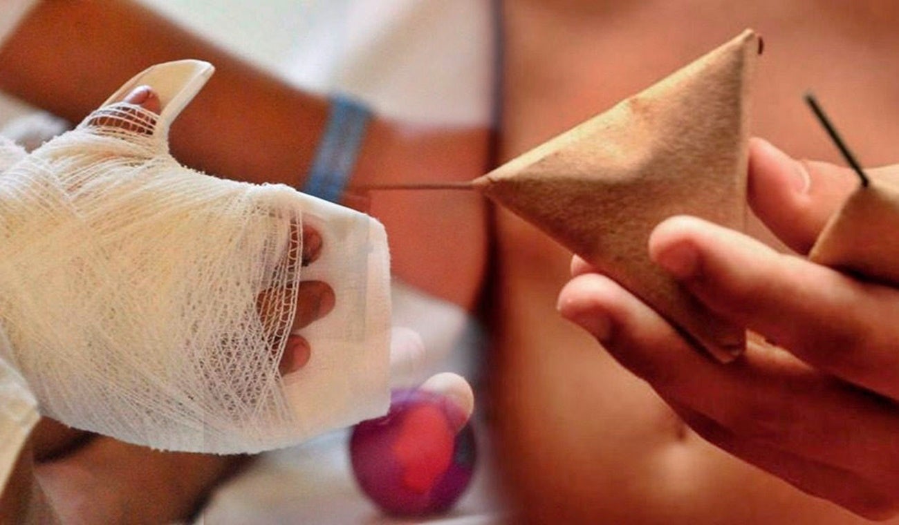 Lesionados por pólvora