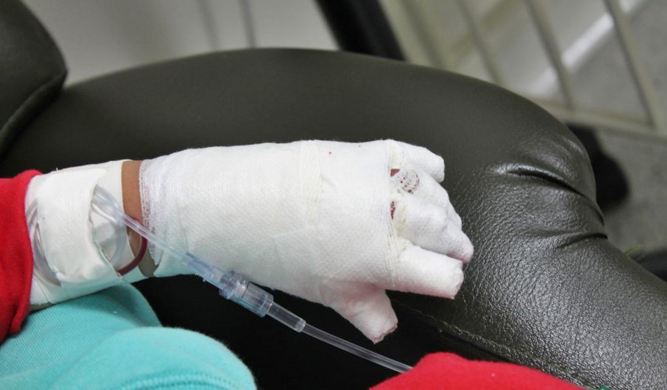 Quemado por pólvora