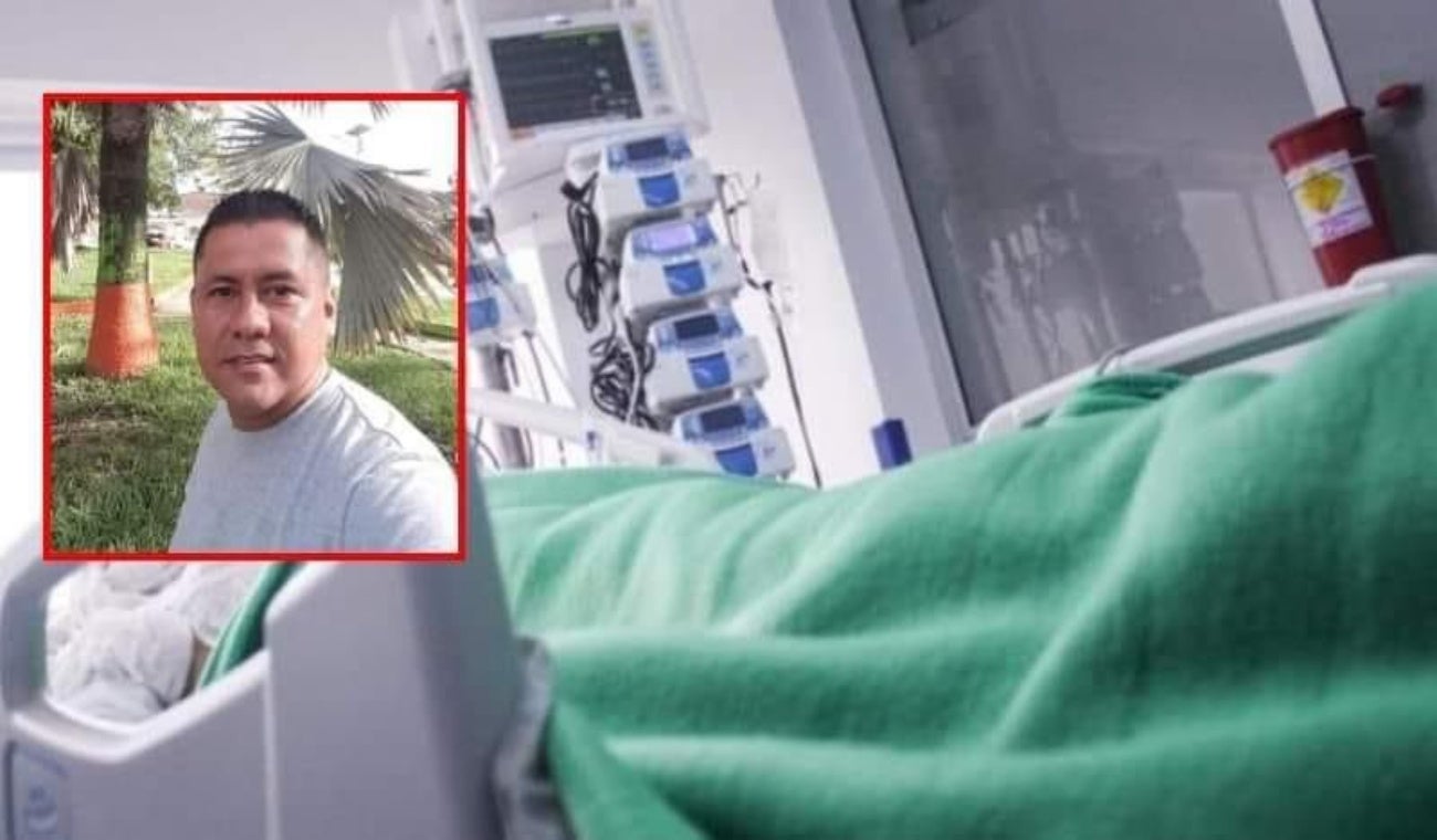 Quemado por su expareja en El Espinal