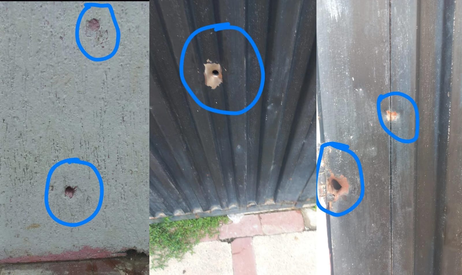 En delicado estado de salud se encuentra menor víctima de bala perdida en Neiva