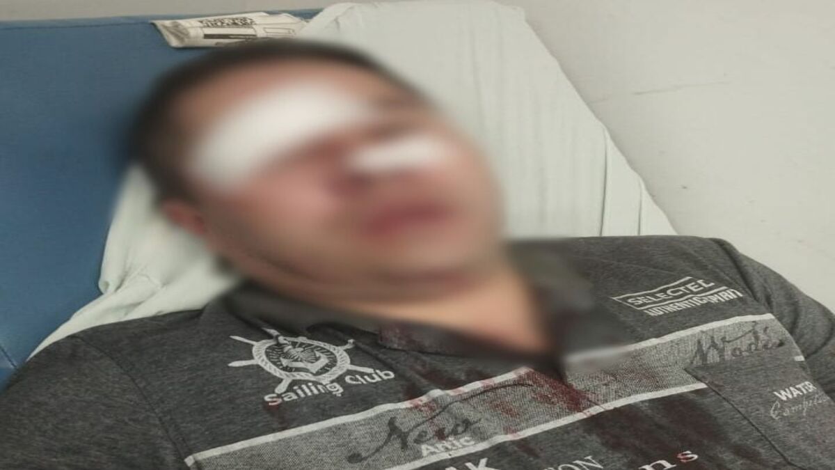 Taxista agredido en Ibagué