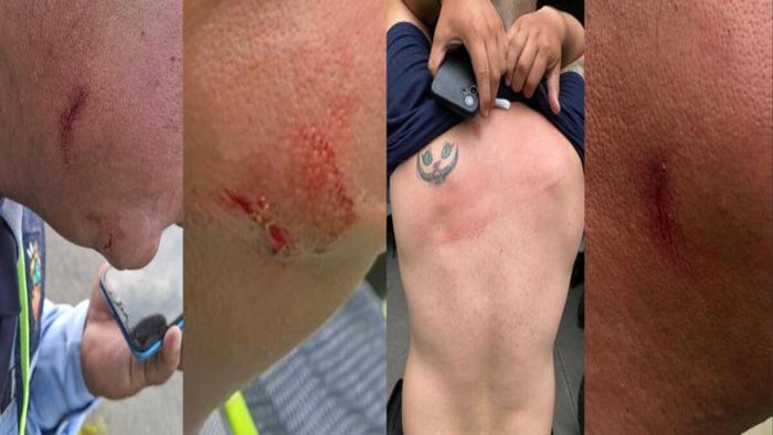 Agresión Agentes de Tránsito