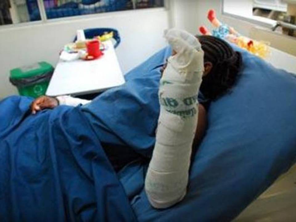 Por temor a las sanciones padres no están reportando a niños quemados