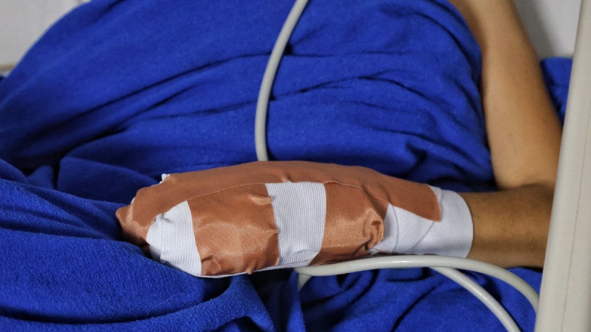 Quemados con pólvora en Tolima | Pólvora en Tolima | Lesionados pólvora | Diciembre 2024