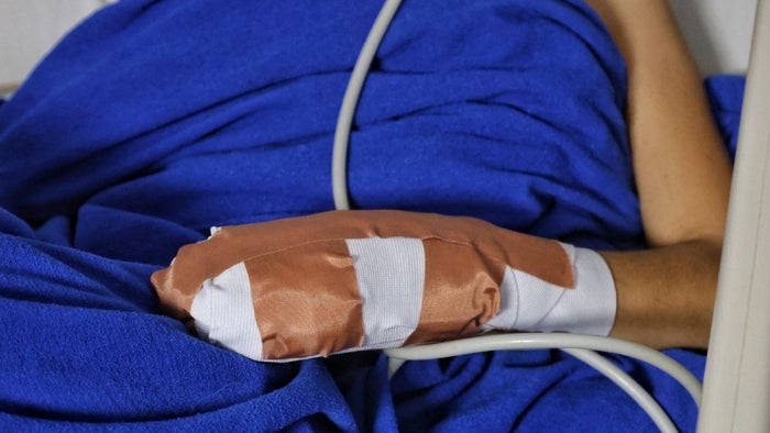 Quemados con pólvora en Tolima | Pólvora en Tolima | Lesionados pólvora | Diciembre 2024