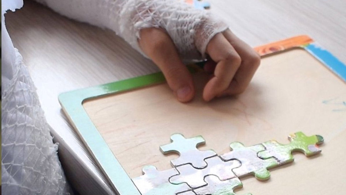 menor quemado por polvora 2025