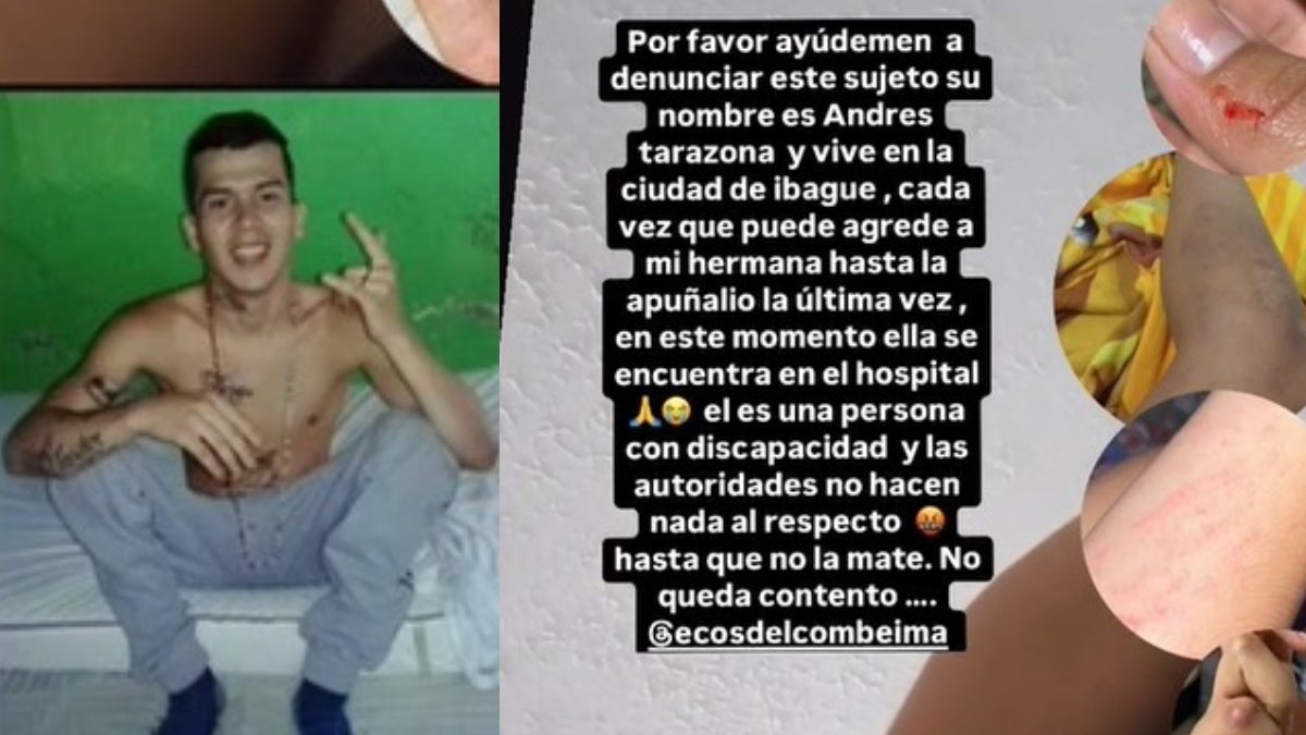 ¡Brutal agresión en Ibagué! Joven teme por su vida tras ser atacada por su pareja