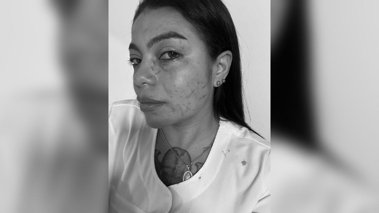 Ciudad Bolívar: Mujer golpeó y arañó a una enfermera por llorar su hijo en procedimiento médico