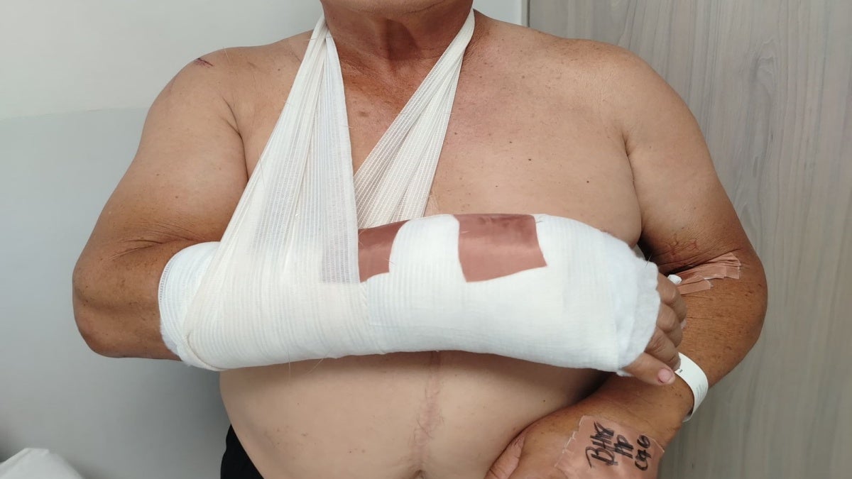 Víctima agresión barrio Santa Rita