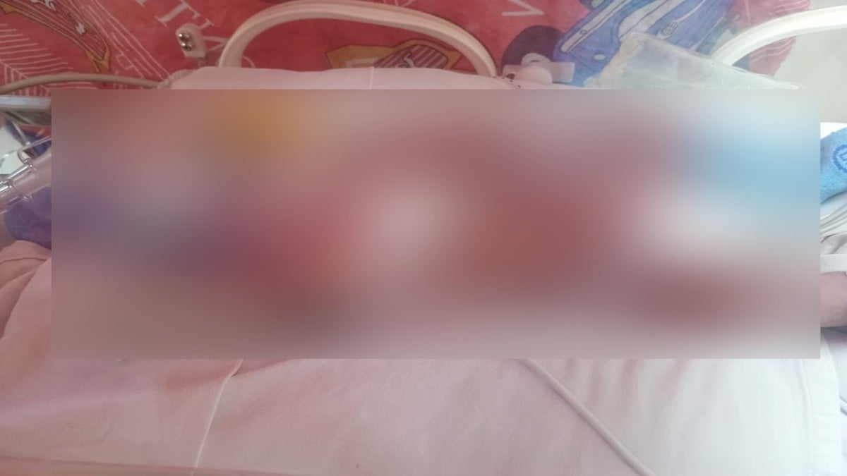 Bebé fallecido en Ibagué