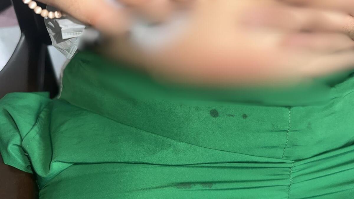 Menor herida | Presunto ataque | Menor colegio San Simón | Agosto 2025