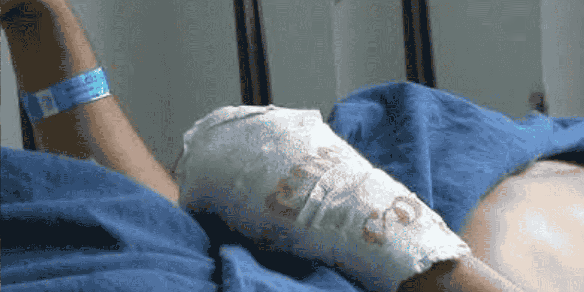 Reportan el primer lesionado por pólvora en el Tolima durante la temporada de fin de año