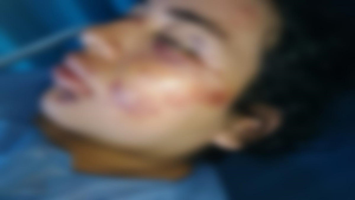 Domiciliaria accidentada