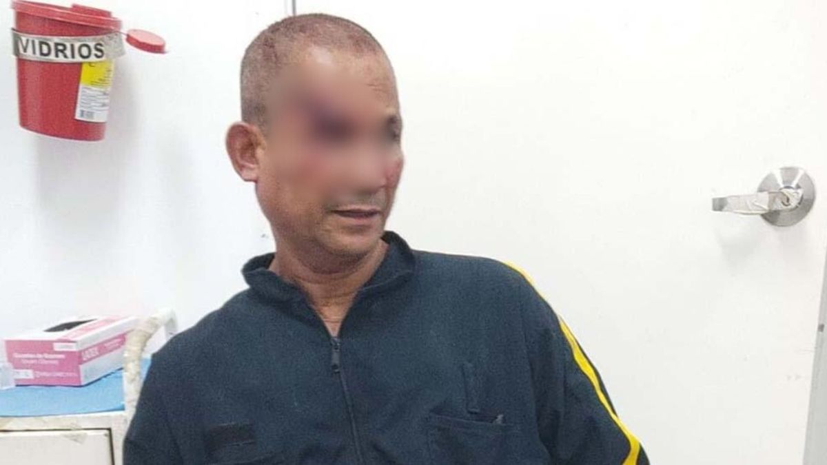 Imagen del vigilante con heridas en la cabeza