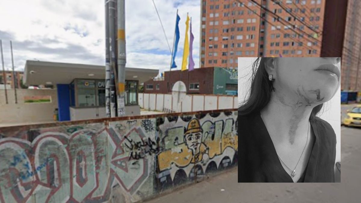 Veterinaria denuncia agresión frente a CAI en Bosa Casi no la cuenta