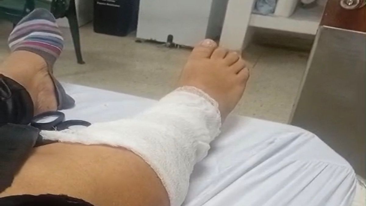 Mujer con fractura sin atención de Asmet Salud