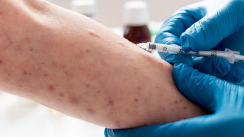 Vacunas del sarampión para semana santa