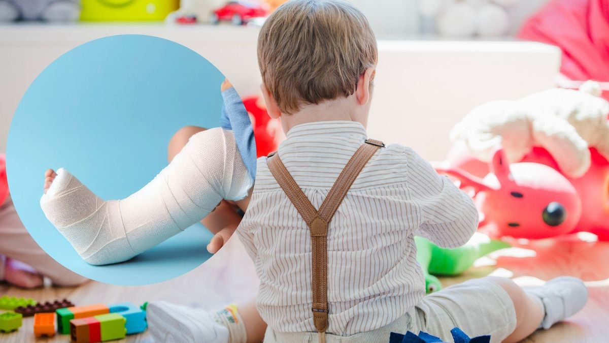 Menor fracturado (imagen de referencia)