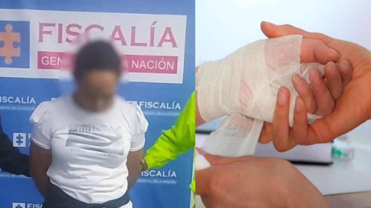 Madre le quemó las manos a su hija en Pereira