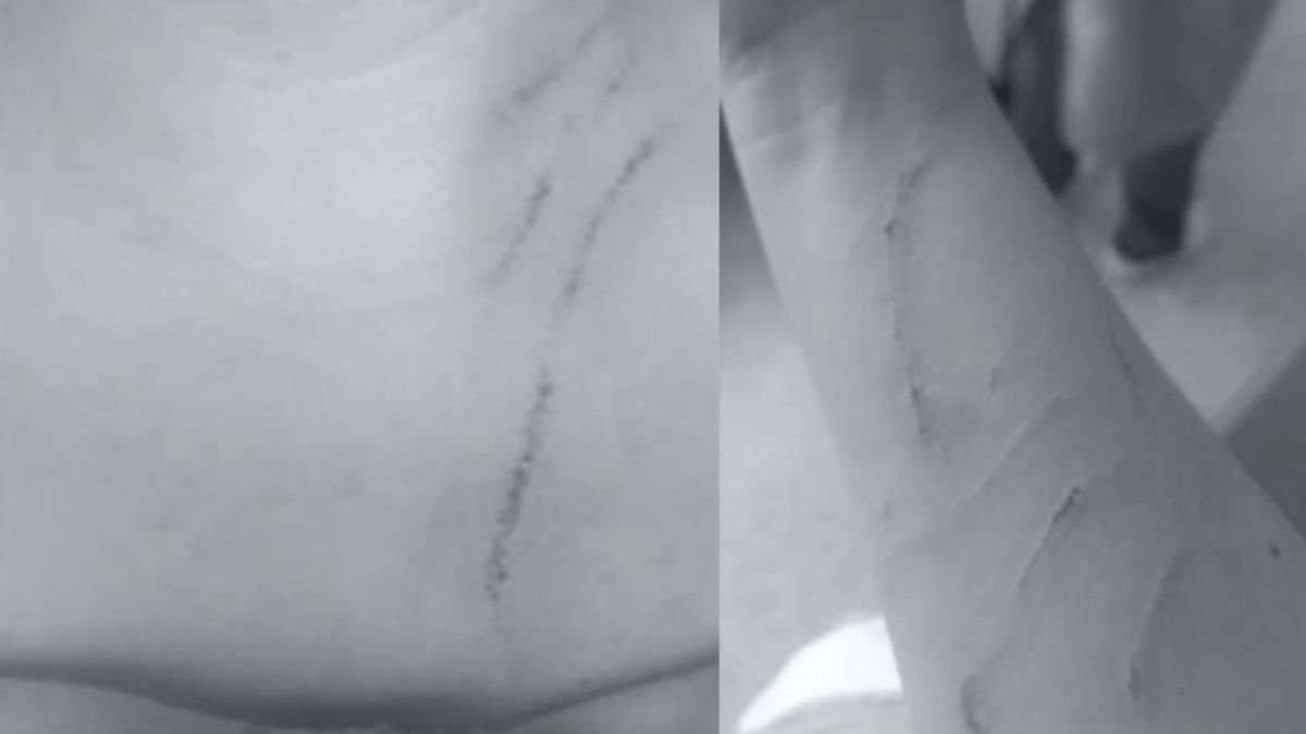 Enfermera agredida en Risaralda