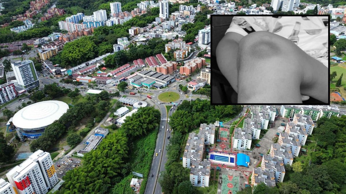 Caso de hemofilia en Armenia