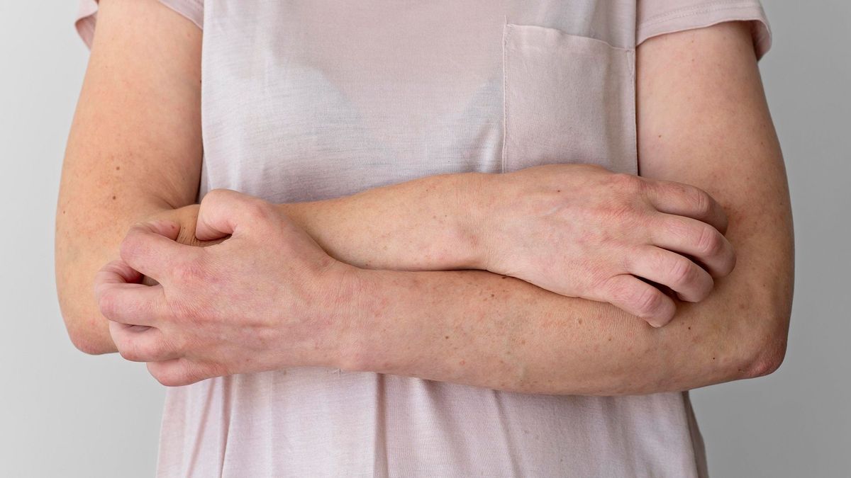Mujer con enfermedad Darier pide eutanasia