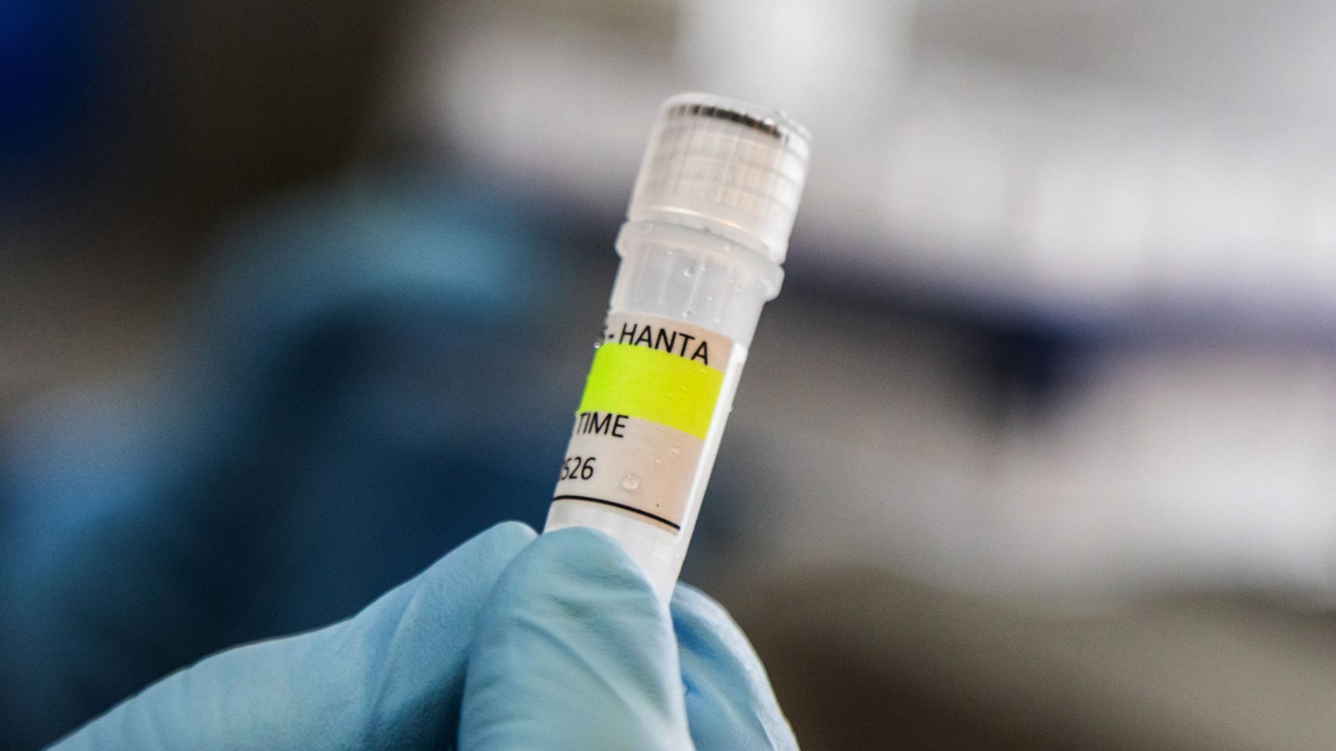 ¿Cómo se transmite el hantavirus y cuáles son los síntomas?