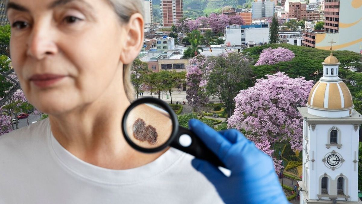 ¿Cuándo y dónde será la jornada gratuita para detectar cáncer de piel en Ibagué?