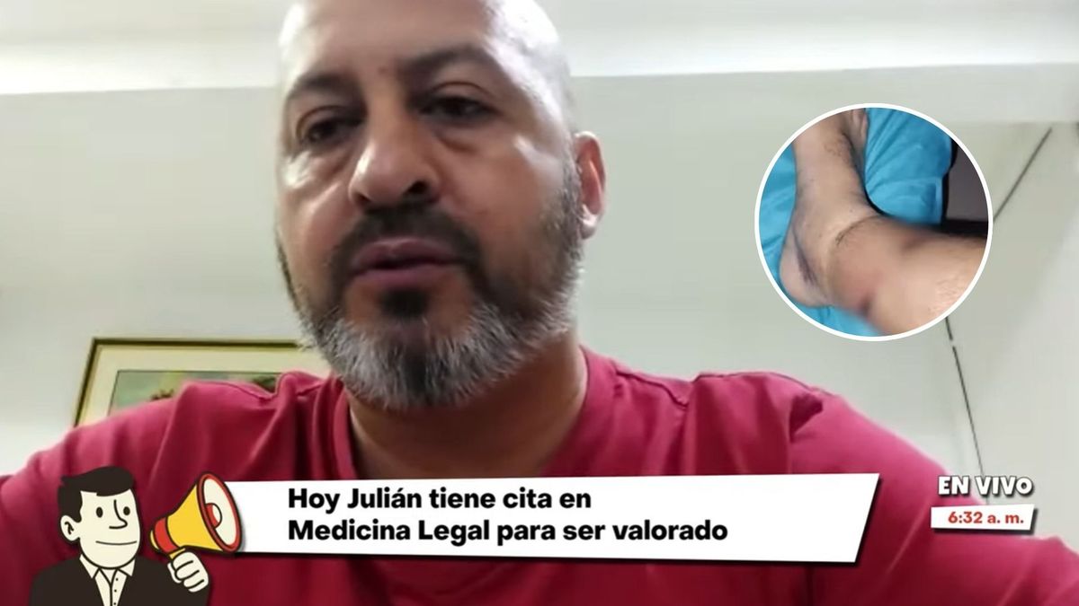 Conductor huyó tras atropellar a ciclista en la calle 80