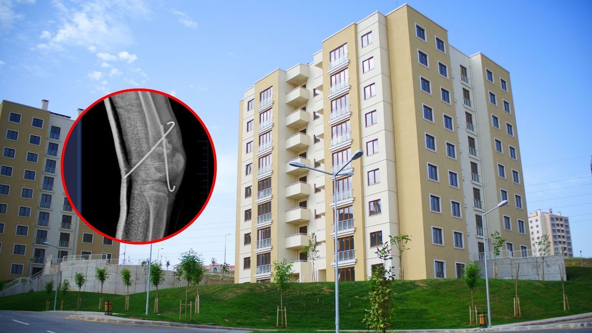 ¿Cómo sobrevivió la niña que cayó desde un séptimo piso en Fusagasugá?