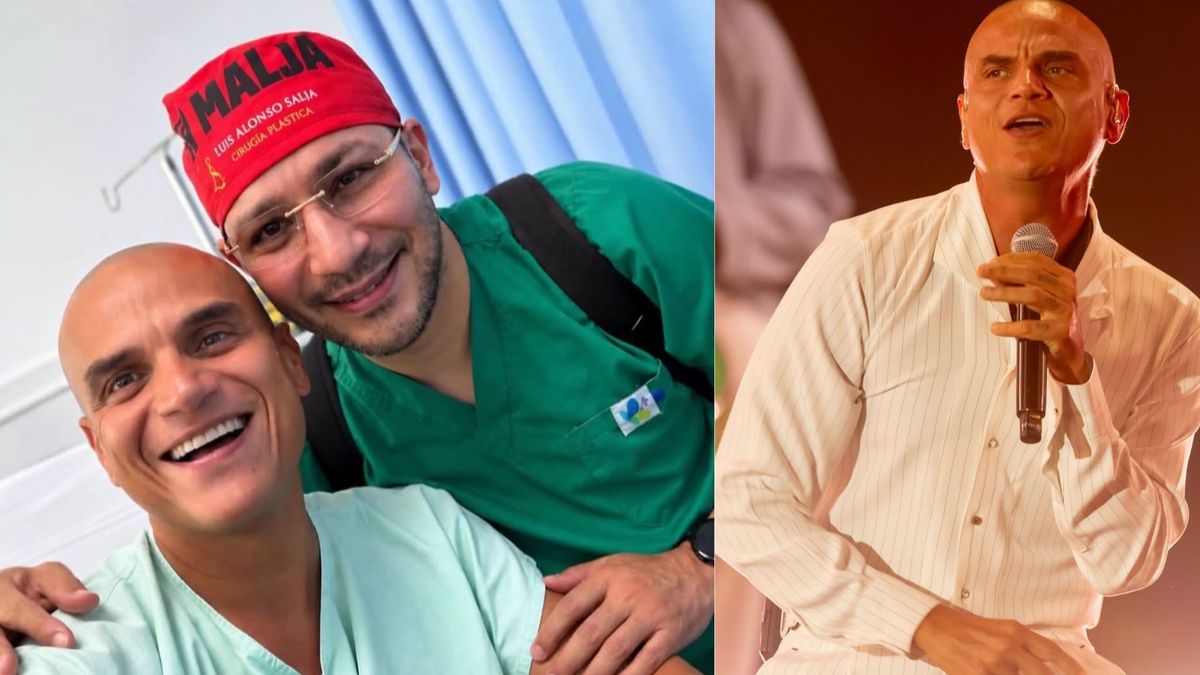 Operaron a Silvestre Dangond