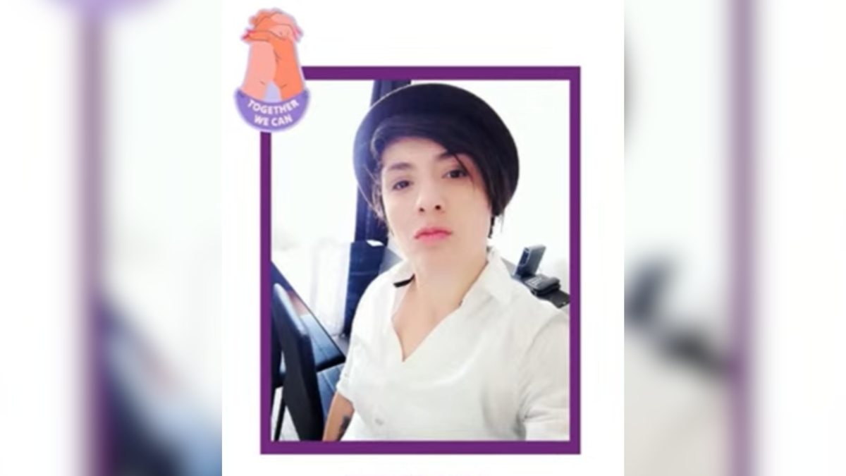 Vanessa Vera Durán, víctima de agresión en Usaquén